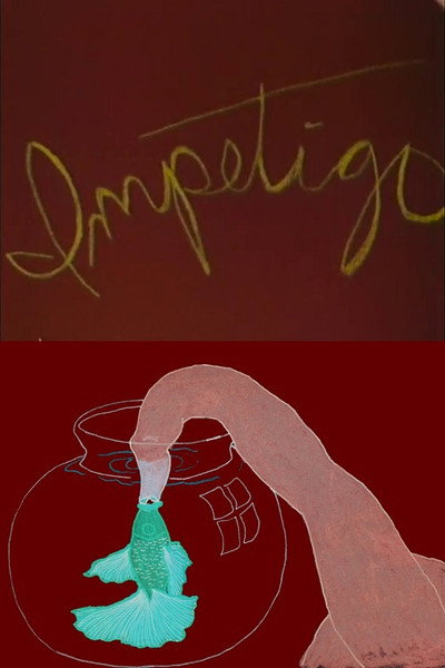 Póster de Impetigo