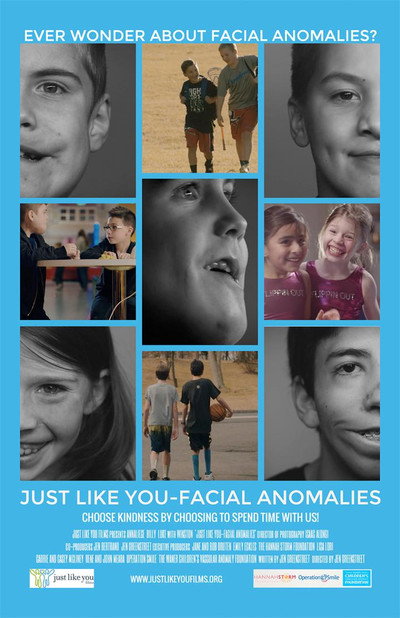 Póster de Just Like You: Facial Anomalies