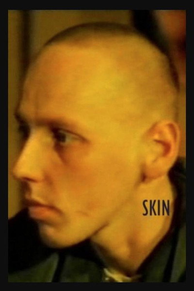 Póster de Skin