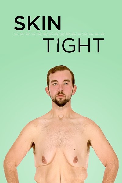 Póster de Mi vida con 300 kilos: Cirugía final